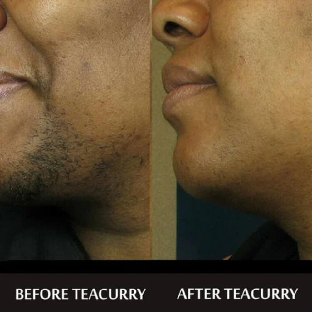 TEACURRY TEACURRY Facial Hair Tea (2 Month Pack | 60 Pyramid Tea Bags) - Helps with Facial Hair Removal and Unwanted Hair Removal