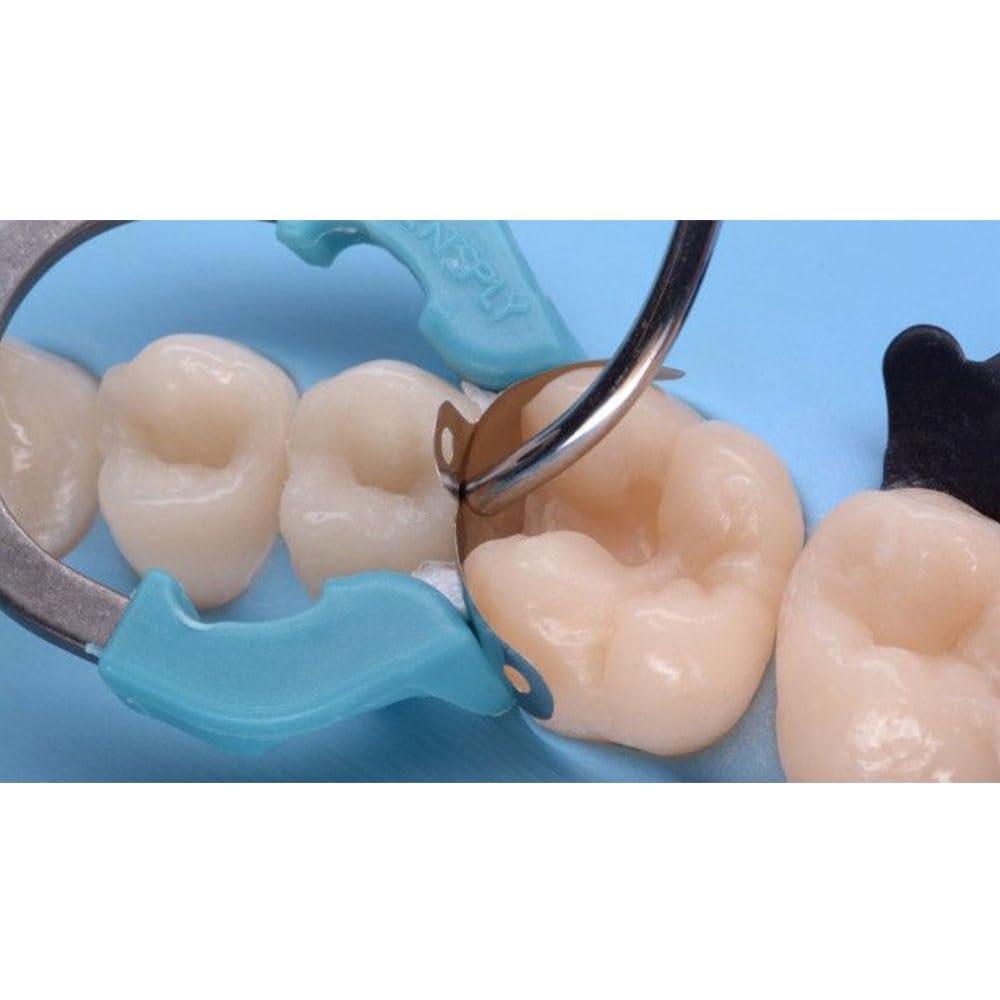 SUPERENDO SuperEndo Russia Tor Vm Lug Matrices Set (1.368) - 30 Pcs, Concave Stainless Steel Matrices for Type II Restorations, Corrosion-Resistant, Durable, Easy to Burnish, Ideal for Dental Procedures