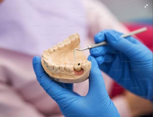 Generic DENTAL STONE POWDER 1KG / GREEN STONE 1KG / DENTAL STONE PLASTOR/GREEN STONE PACK OF 1KG / DENTAL STONE PACK OF 1 KG