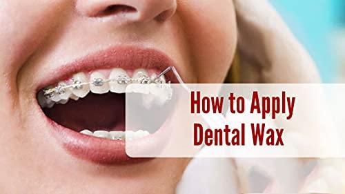 Dentosmile Dentosmile Orthodontic Wax for Braces/Patient Relief Wax - 5 Strips Per Box