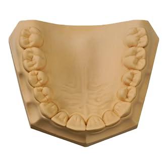 Generic Stone Plaster Dental Die Stone Type IV 3kg (Red Die Stone)