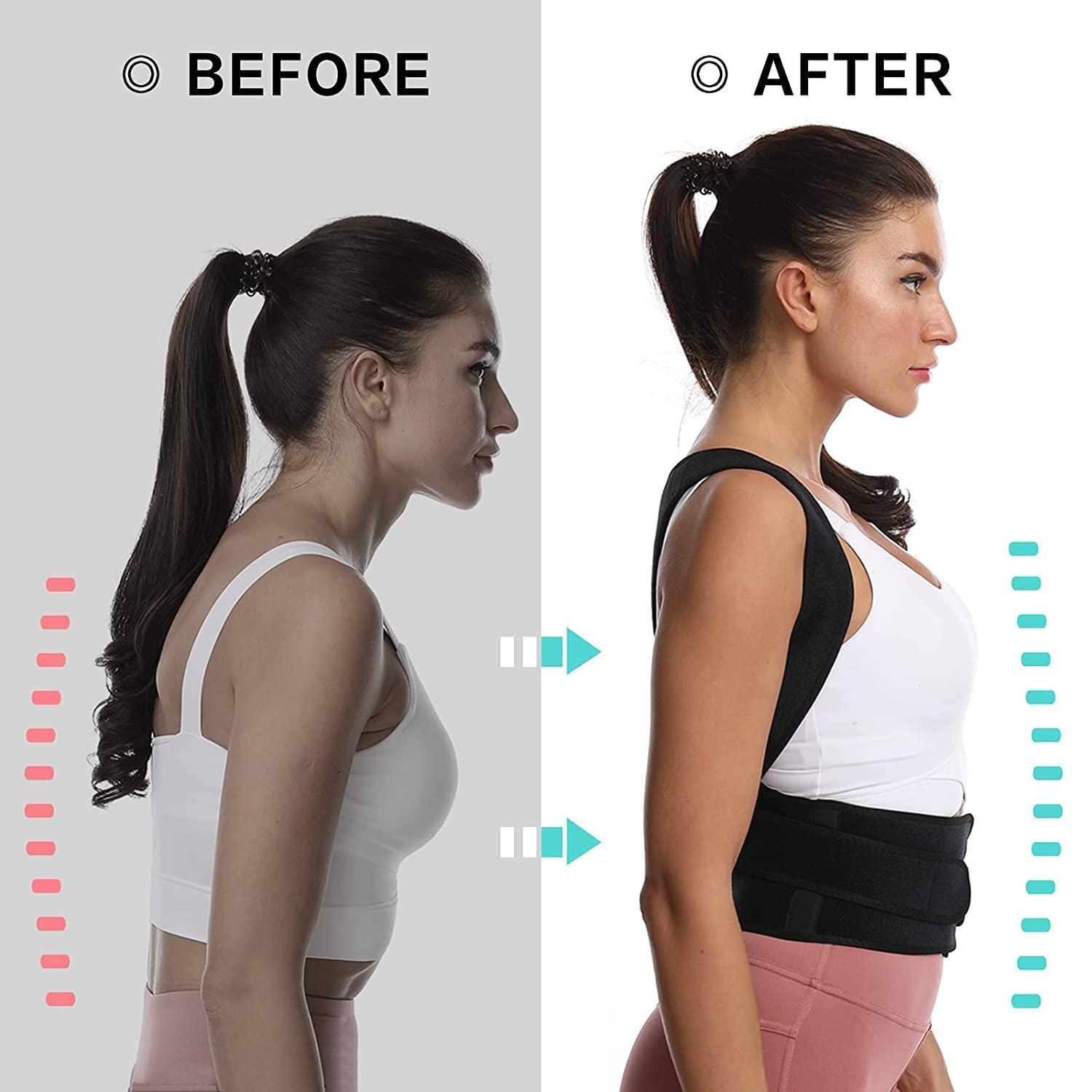 VK SURGICAL VK SURGICAL Premium Magnetic Back Brace Posture Corrector Therapy Shoulder Belt for Lower & Upper Back Pain Relief with Back Support Plates for Woman (Free Size)