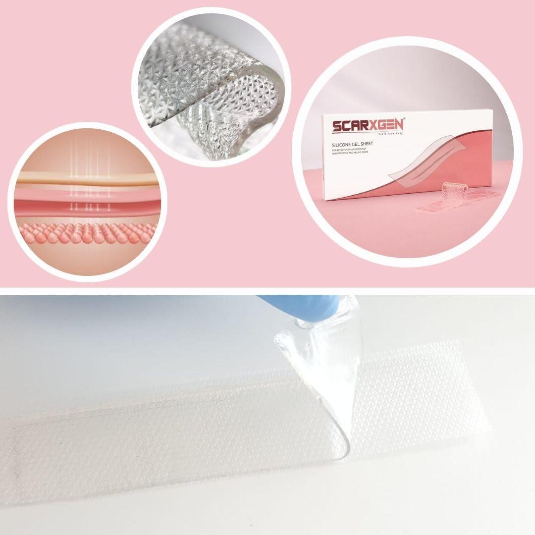 SCARXGEN Scarxgen Silicone Gel Sheet | Scar Sheet | Scars, Cuts and Scrapes, Laparoscopic scar | Reusable and Washable Sheet | Keloid and Hypertrophic scar I Visible scar reduction (3CMX20CM(BOX OF 1 UNIT))