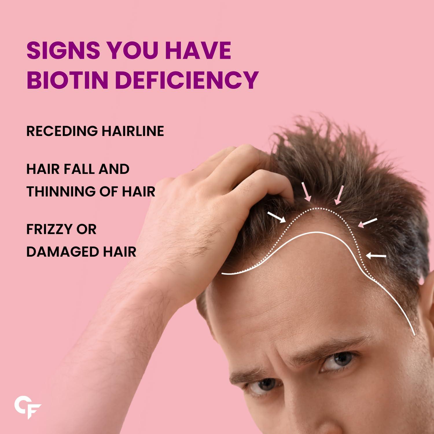 Carbamide Forte Carbamide Forte Biotin 10000mcg | Biotin Tablets for Hair Growth | Biotin Supplement for hair, skin, and nails | Hair Vitamins for Men & Women | 120 Tablets