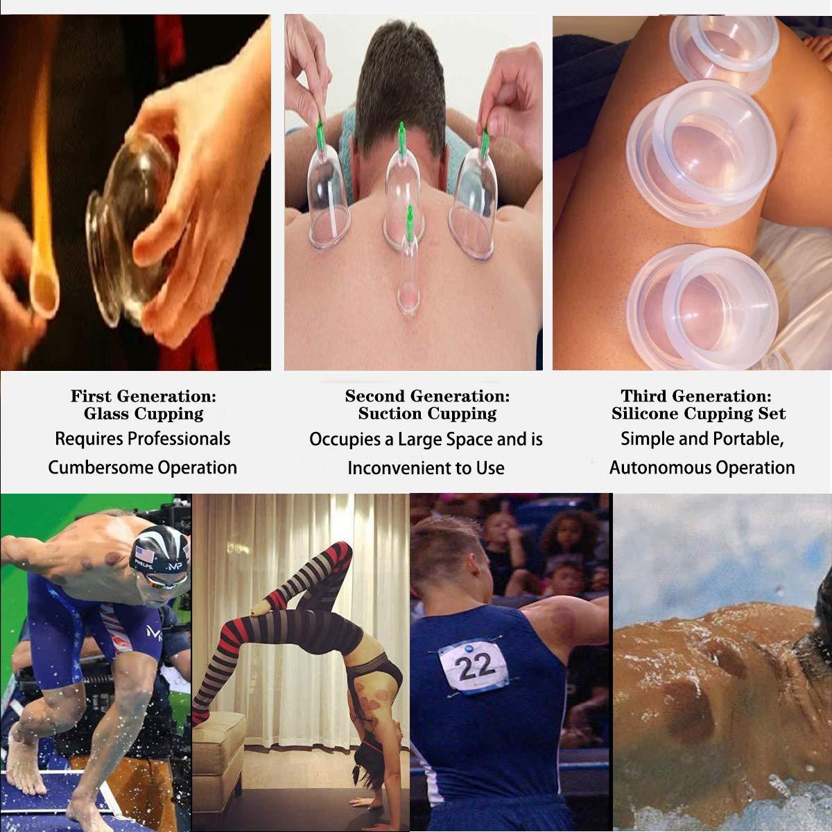 CFHBF CFHBF 4 Size Cupping Therapy Sets Silicone - Cupping Therapy Professional Studio And Home Use Cupping Set,Stronger Suction Best For Myofascial Massage,Anti Cellulite,Muscle,Nerve,Joint Pain Relief