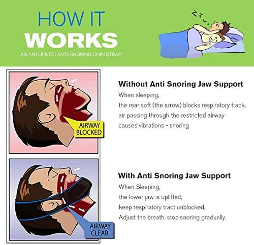 Atrilly Atrilly Anti Snoring Chin Strap Ajustable Stop Snoring Solution for Men and Women, Anti Snoring evices Snore Stopper Chin Straps Sleep S for Snoring Sleeping Mouth Breather