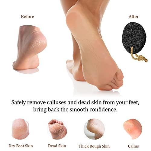 Pumice Valley Black : Pumice Valley - Natural Lava Pumice Stone Black - Callus Remover for Feet Heels and Palm - Pedicure Exfoliation Tool - Remover Toxins - Corn Remover for Foot - Dry Dead Skin Scrub - Health Foot Care