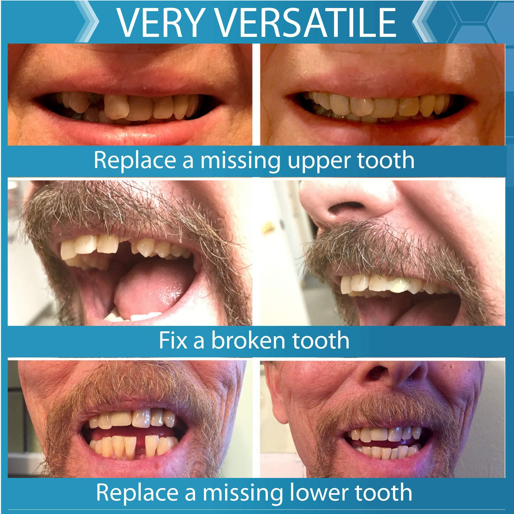 Instant Smile Instant Smile Complete Your Smile Temporary Tooth Replacment Kit - Replace a missing tooth in minutes
