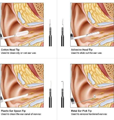 Abhsant Abhsant Ear Cleaning Endoscope with 6 LED Light and Ear Wax Removal Tool Suitable for Tablet and Computer, Digital ear otoscope inspection with adjustable LEDs and waterproof camera