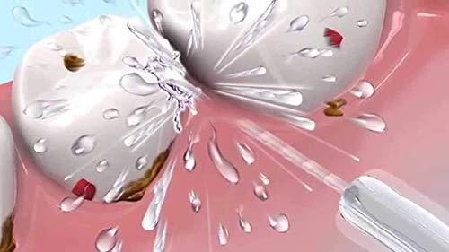 SKYLIT SKYLIT (Pack-2) Water-Jet Flosser Air technology Cords Speed Dental Care Tooth Pick Power Dental Cleaning Whitening Teeth Kit Power Floss Air Powered Dental Water Jet for Tooth Cleaner Teeth Using (Wh