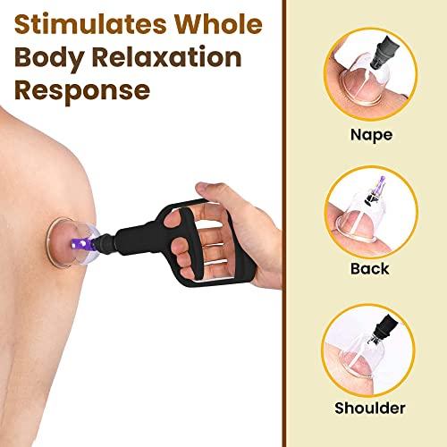 CRESCENT Crescent Hijama| Cupping Therapy Cups| Hijama Cupping Set| (Size 1, 6 Cups only)