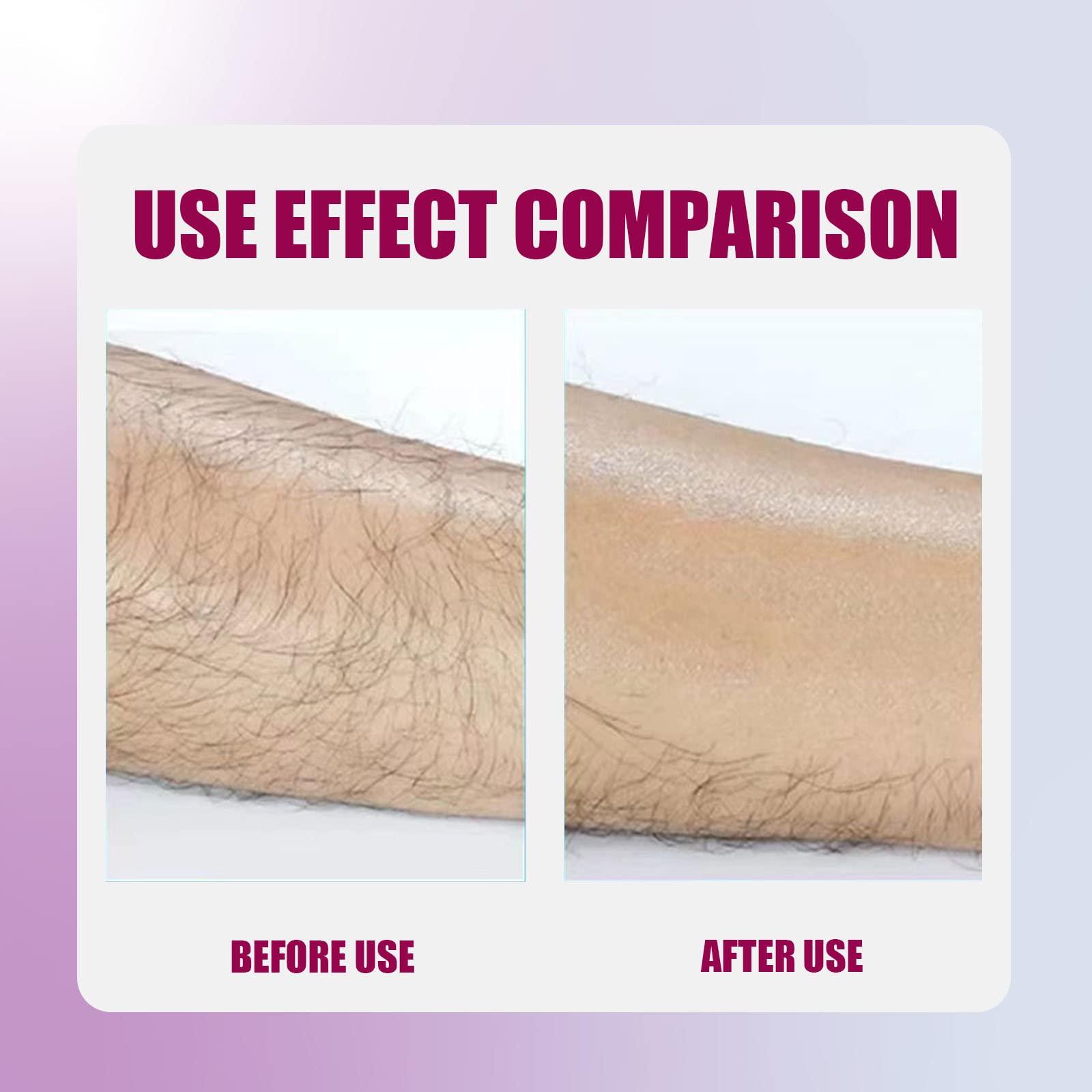 Bleame Bleame Crystal Hair Eraser, Bleame Crystal Hair Remover, for Men & Women Arms Legs Back, Fast & Easy Exfoliate, Soft Smooth Silky Skin, Apply To Any Part Of The Body (Purple) (Black)