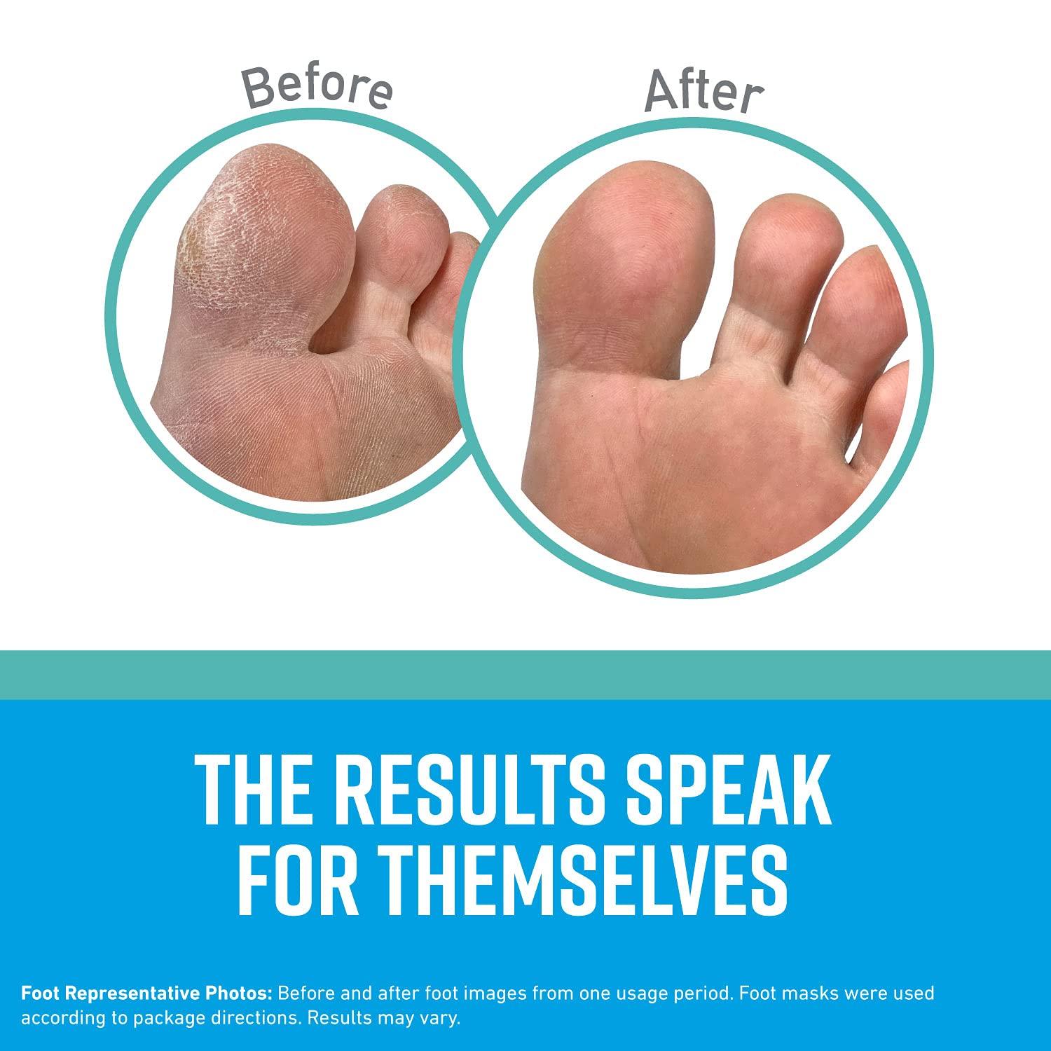 O'Keeffe's O'Keeffe's for Healthy Feet Intensive Moisturizing Foot Mask, Guaranteed Relief for Extremely Dry, Rough Feet, One Pair Single-Use Hydrating Foot Mask Socks, (Pack of 2)