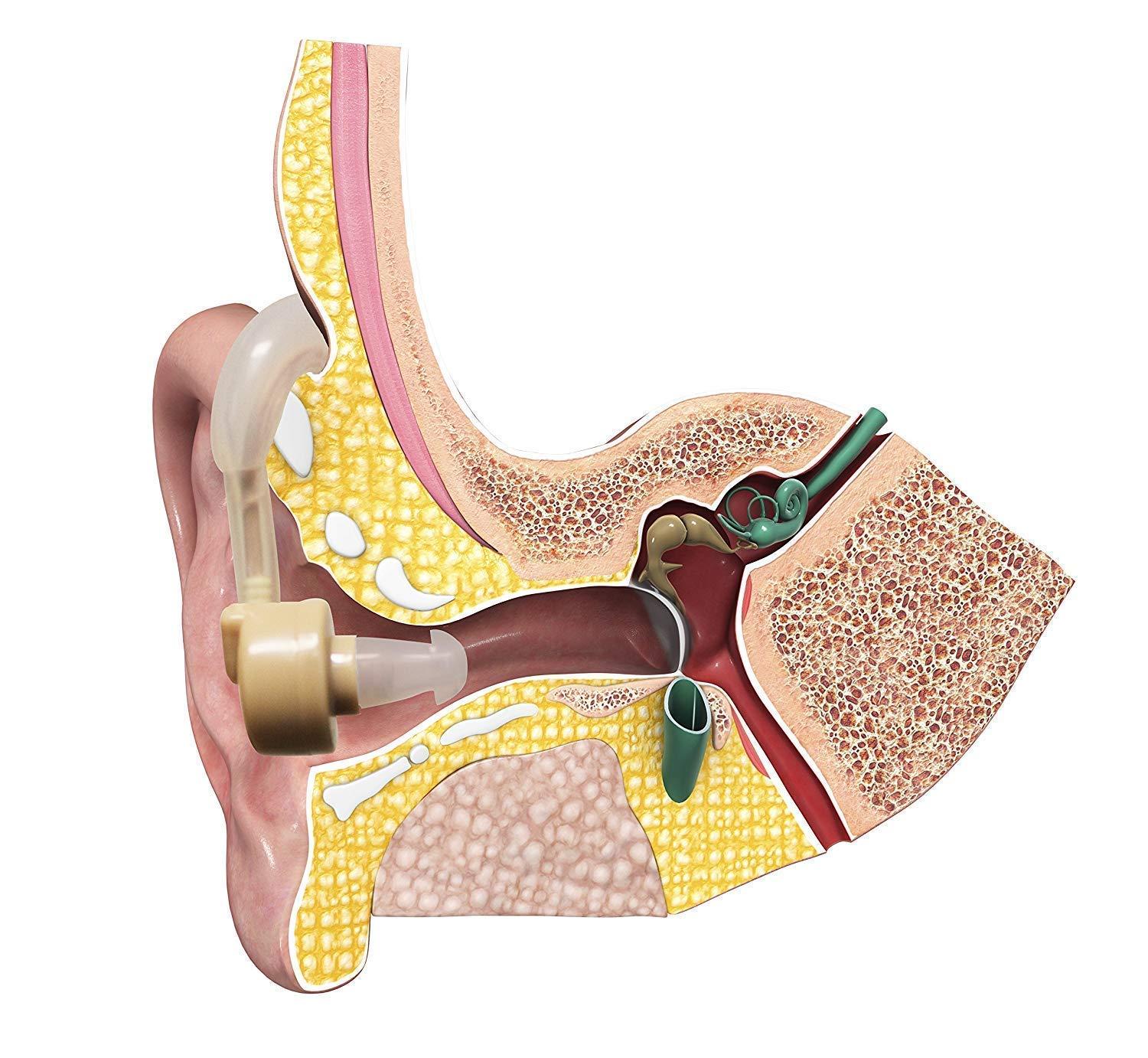 MORGHULIS MORGHULIS ound Enhancer Hearing Aid Bionic Ear Sound Amplifier Mini Size BTE Behind Cyber Sonic Ear hearing machine Behind the Ear Hearing Aid Bionic Ear Sound Amplifier PACK of 1