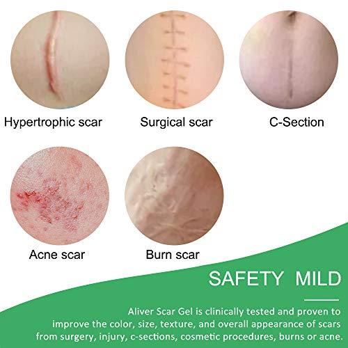 Purvigor Reusable Silicone Scar Removal Sheets, Professional Silicone Scar Sheets, for Scars Caused by C-Section, Surgery, Burn, Injuries, Acnes and Stretch Marks, Works on Old & New Scars, 4 Sheets