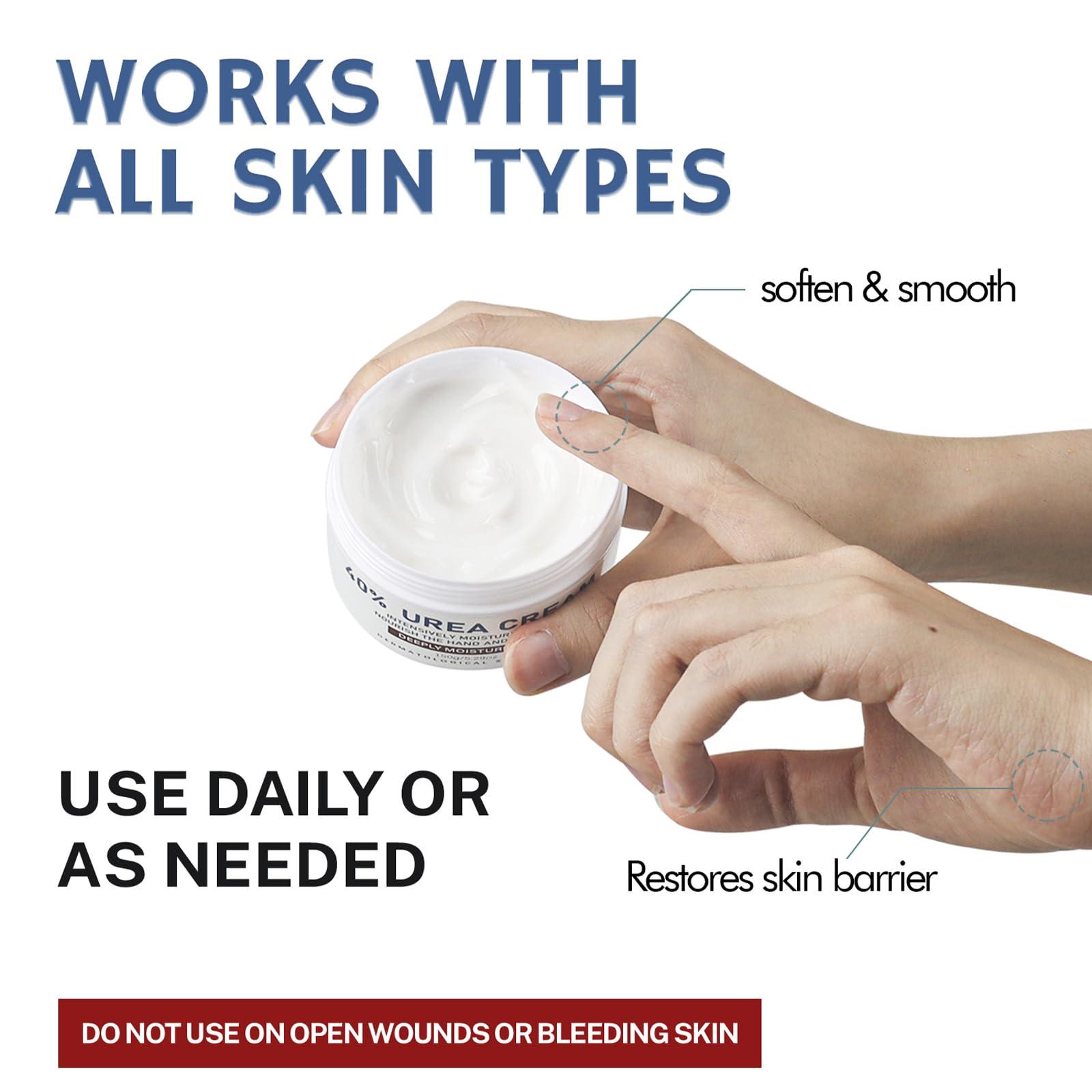 OUKEYA OUKEYA Urea Cream 40 Percent, Urea Foot Cream for Dry Cracked, 40 per Urea Lotion for Feet Maximum Strength