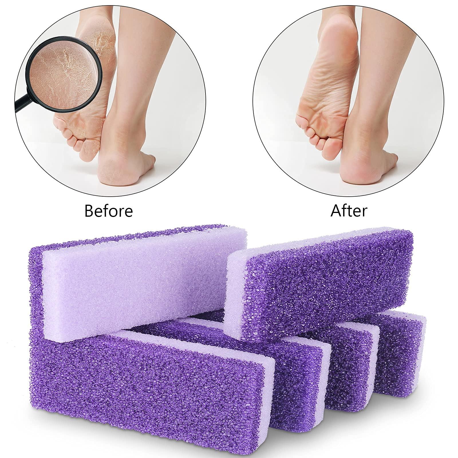 NANASO 2 in 1 Pumice Stone for Feet,6 Pack Foot Scrubber & Callus Remover, Stone Scrubber for Hard Skin,Foot Pumice,Dead Skin Remover for Feet, Heels, Hands and Body