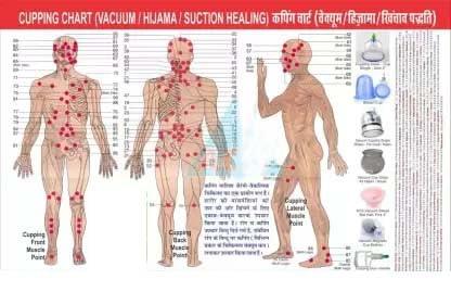 ANCS ANCS Acupressure 24 Vacuum Cups Chinese Medicine Magnet Therapy Cupping Set Acupuncture Manual Massager for Pain Relief Multicolor