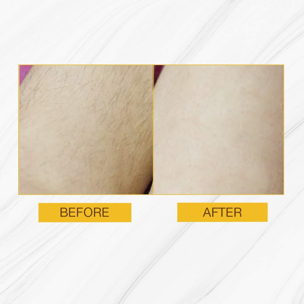 GiGi Gigi Hair Removal Strips for The Body, 24 Applications & 29 ml, 1 Fl. Oz. After wax lotion