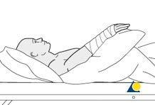 METRON METRON-Hand Arm Wrist Support Slope Elevator for Recovery, Stabilization from Swelling Edema Splinting Fabrication Stroke Recovery