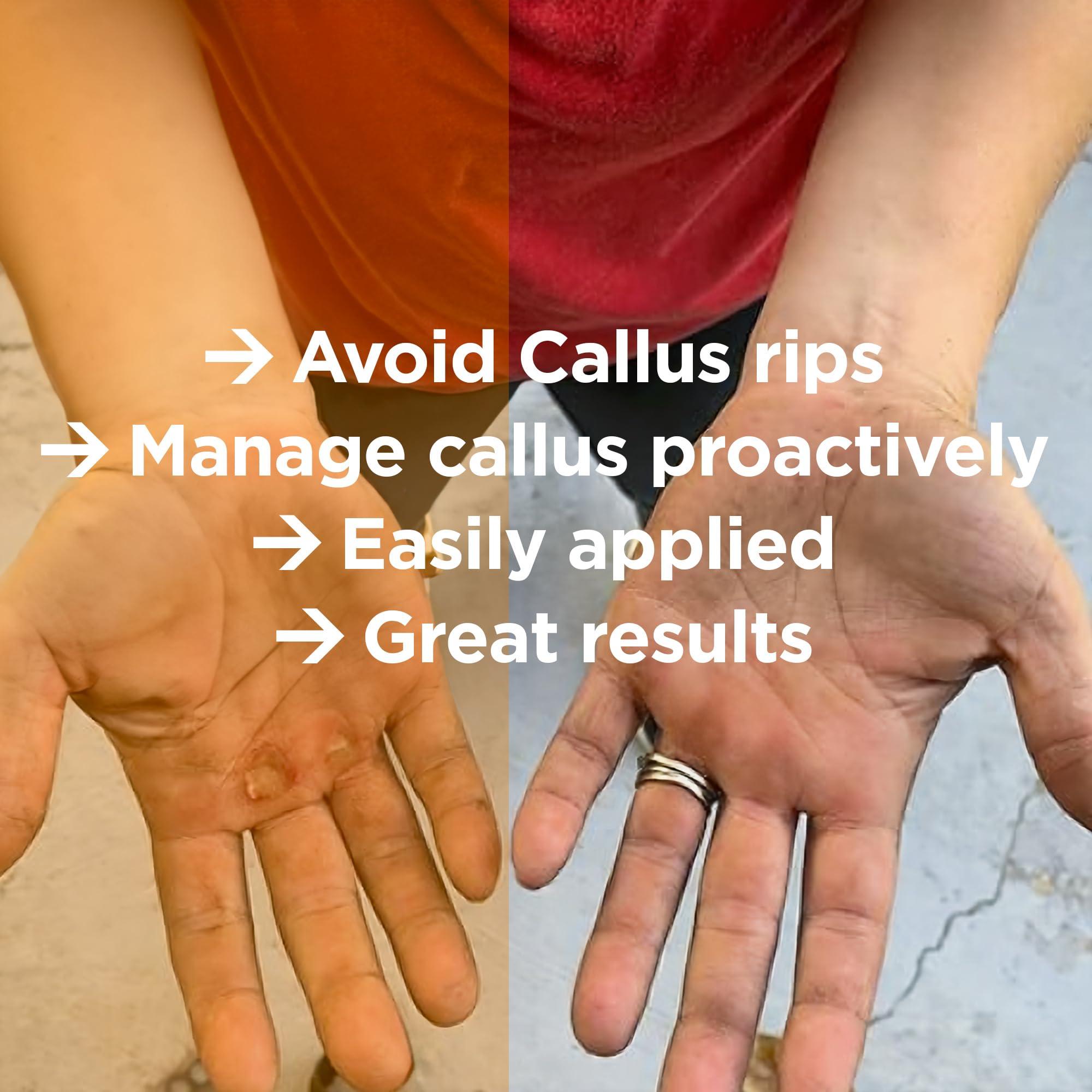 Callus Performance Callus Performance Callus Performance - The Ultimate Callus Remover for Crossfit Athletes and high Friction Hand use. l Remove unwanted Calluses I Prevents Ripping and Tearing of Hands I