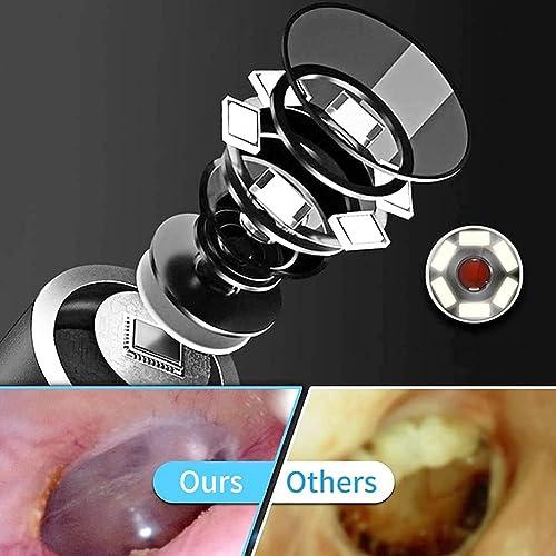 Abhsant Abhsant Ear Cleaning Endoscope with 6 LED Light and Ear Wax Removal Tool Suitable for Tablet and Computer, Digital ear otoscope inspection with adjustable LEDs and waterproof camera