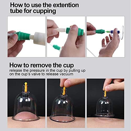 Generic Hijama 12 Cupping Cups Bio Magnetic Traditional Chinese Therapy Cupping Set Household Pull Out Vacuum Cupping Kit/Chinese Massage Medical Cupping Set Suction Acupuncture with Extension Tube