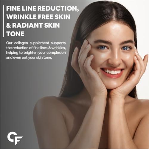 Carbamide Forte Carbamide Forte Hydrolyzed Multi Collagen Powder With Marine Collagen, All 5 Types of Collagen Peptides Included - TYPE I, II, III, V, X Collagen Supplements for Women & Men, Watermelon Flavor - 200g