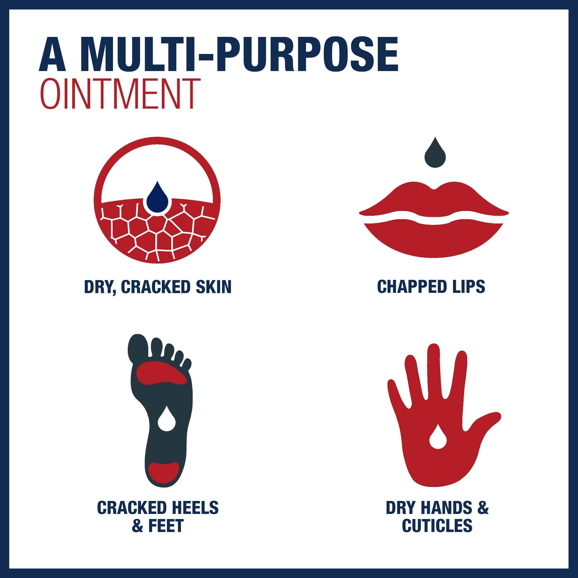 Aquaphor Aquaphor Healing Ointment, Dry, Cracked And Irritated Skin Protectant, 198g / 7oz