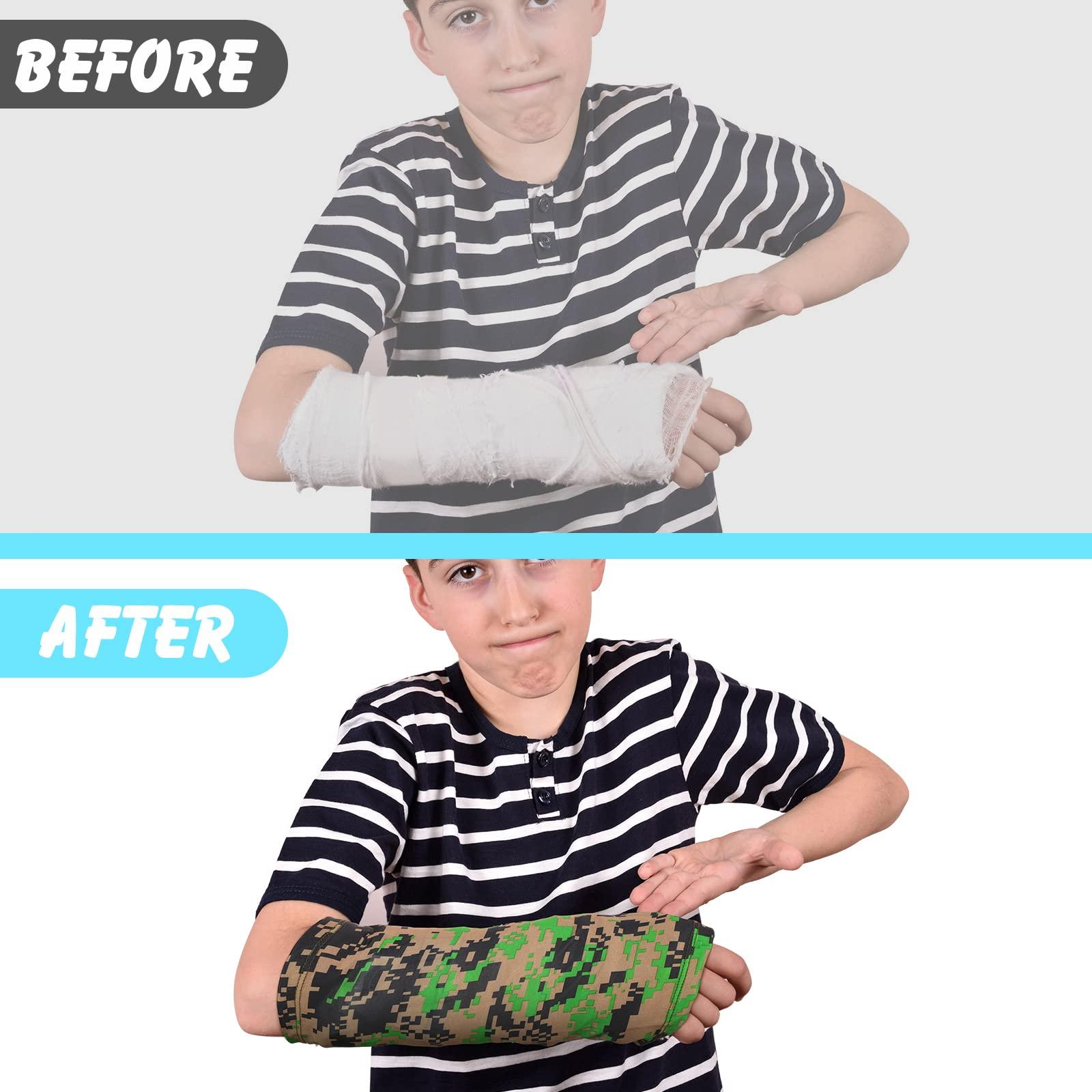 Boao 6 Pack Arm Cast Cover Elastic Cast Sleeve Arm Decorative Cast Cover Removable Washable Arm Cast Protector