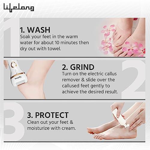 Lifelong Lifelong Callus Remover for Feet | 1 Year Warranty | Foot Scrubber for Dead Skin, 3 Roller Heads, Feet Dead Skin Remover, Pedicure Machine, LED Display, Fast Charging, 2 Hour Runtime (White)