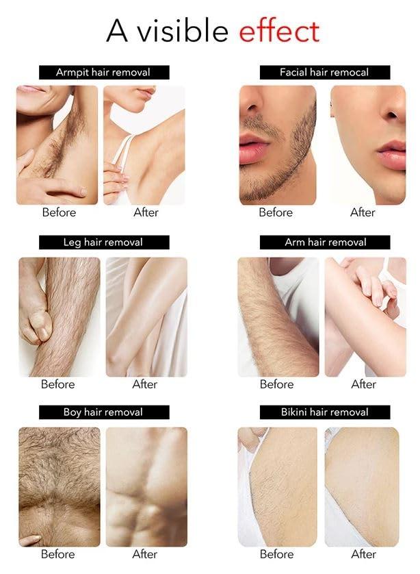 Zusaca Zusaca Hard Wax Beans for Waxing, Hair Removal Face Leg Chest Back Bikini, Hard Sensitive Skin, Facial Cream, Pearl Hand Hot Wax Beads For Mens Women Body, Revolution Remover - 200 g (Azulene)