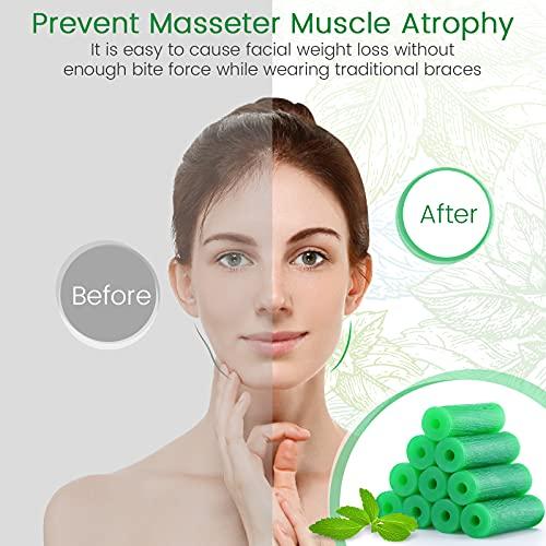 melonsun Aligner Chewies for Invisalign Aligners Mint Scented (20 Pcs Green) and Aligner Removal Tool (2 Pcs Pink)