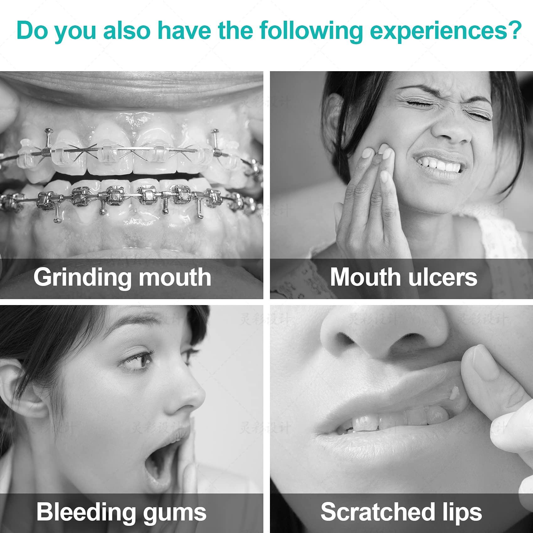 Annhua Annhua Orthodontist Wax Brace Wax Flavored 10 Pack, Dental Ortho Dots Wax Strips for Aligners, Braces Wearer, Brackets, Invisible-lingers, 10 Fruit Smell