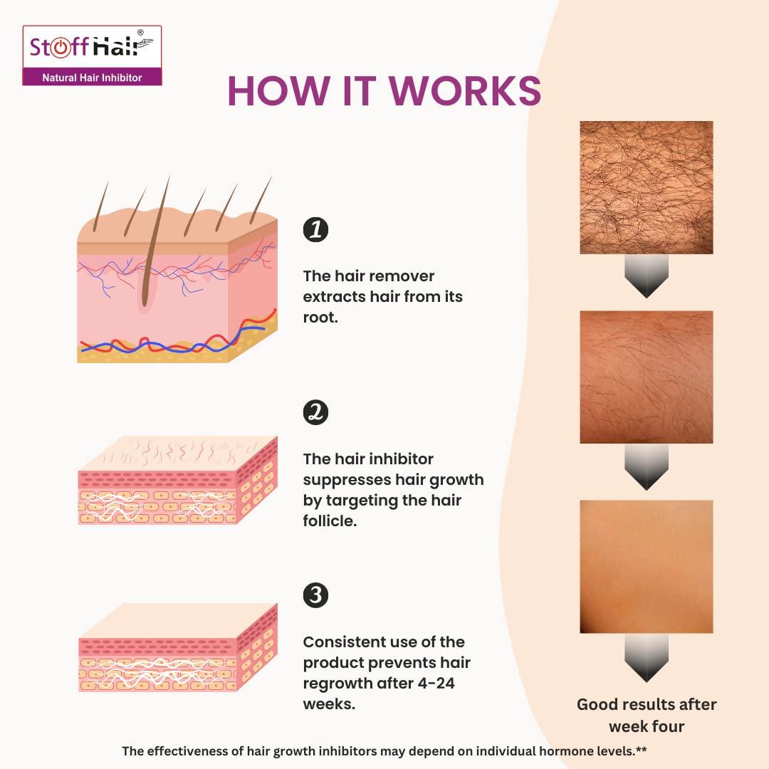 Stoffhair Stoffhair Dr. Benade\'s Cream Hair Inhibitor For Women - Permanent Hair Removal And Body Hair Growth Retarding For Women And Men - Remove Unwanted Facial Hair Without Laser Treatment.