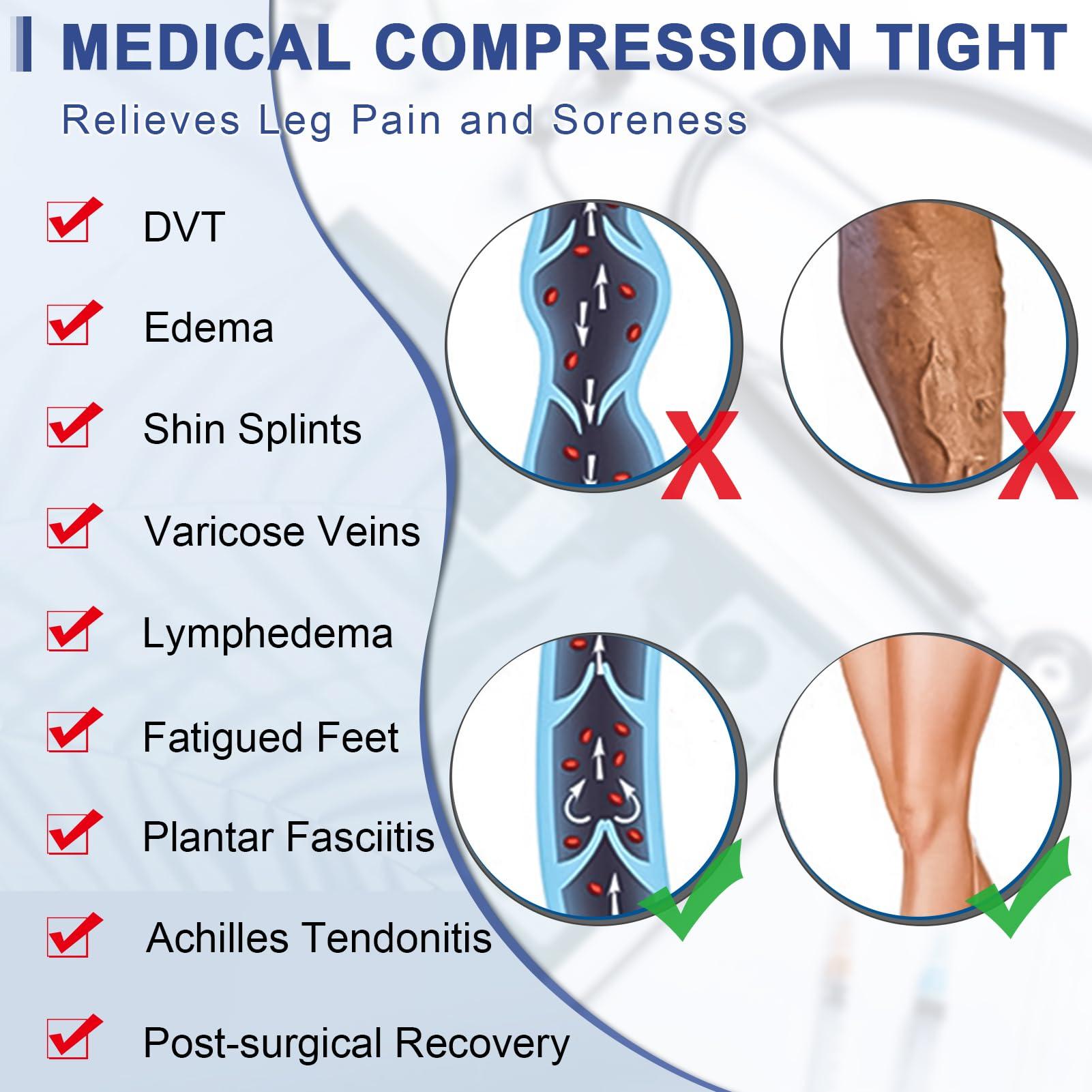 beister Medical Compression Tights for Women & Men, Open Toe Thigh High Pantyhose, 20-30mmHg Graduated Support (Beister), Black, Large