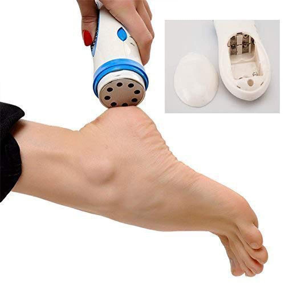 Whitecloud TRANSFORMING HOMES Whitecloud TRANSFORMING HOMES® Pedi spin Personal Pedi Foot Care Callus Remover (ITN-168-300)