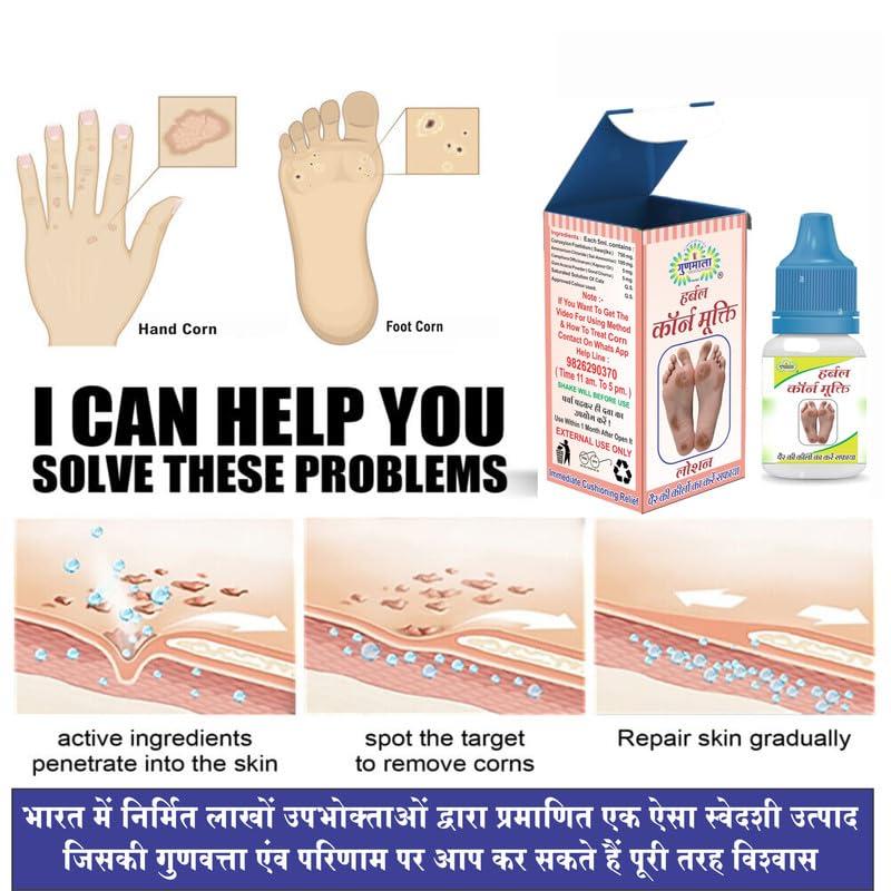 Gunmala Herbals Gunmala Herbals Corn Removal Lotion-Fast Acting Liquid Callus Remover,For Safe Removes Foot Or Hand Corns&Feet Calluses Fast With Cushions,5 Ml. Bottel Pack,Qty.- Pack Of 6