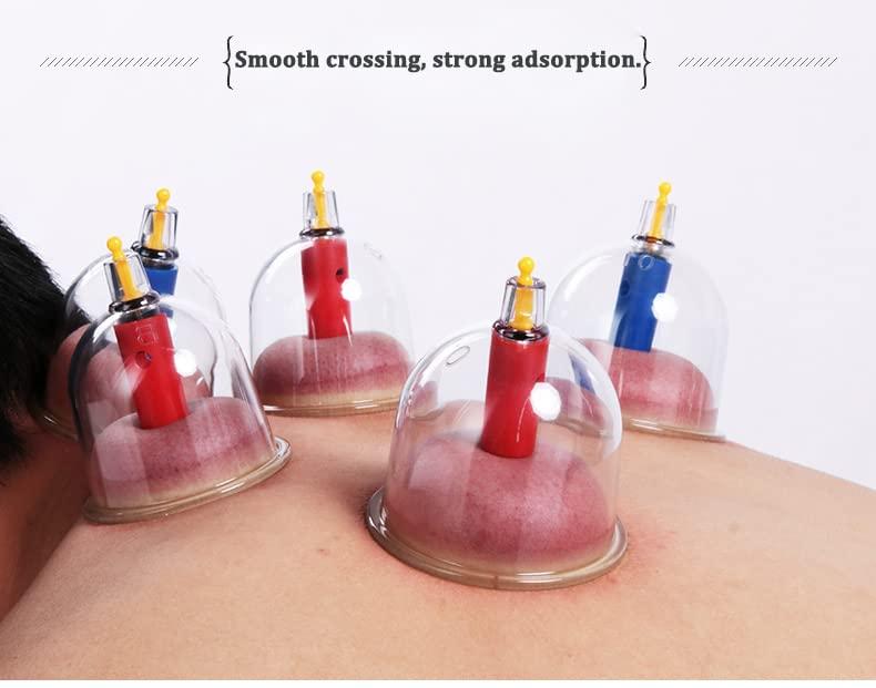 ZCOINS Kangzhu 24-Cup Biomagnetic Chinese Cupping Therapy Set