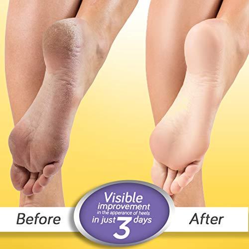 Krack Krack Heel Repair, Ayurvedic Foot care cream, 25 Gm, Pack of 2