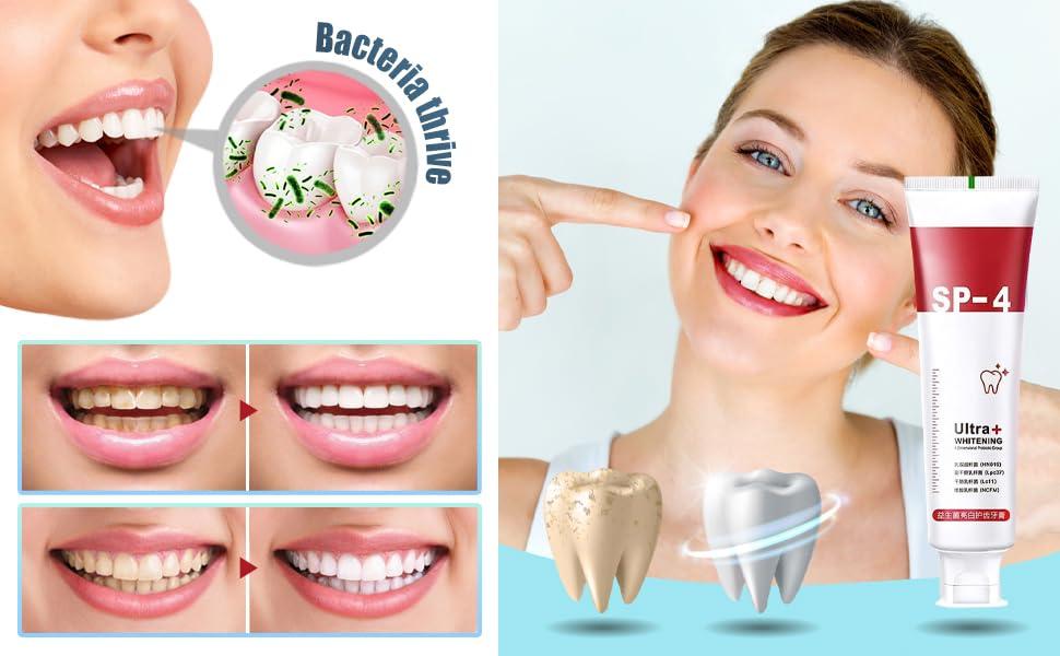 LACASA BEAUTY CARE SP-4 Probiotics Whitening Toothpaste, Sp-4 Probiotic Toothpaste, Yayashi SP-4 Probiotics Whitening Toothpaste, Teeth Whitener Toothpaste (1pcs)