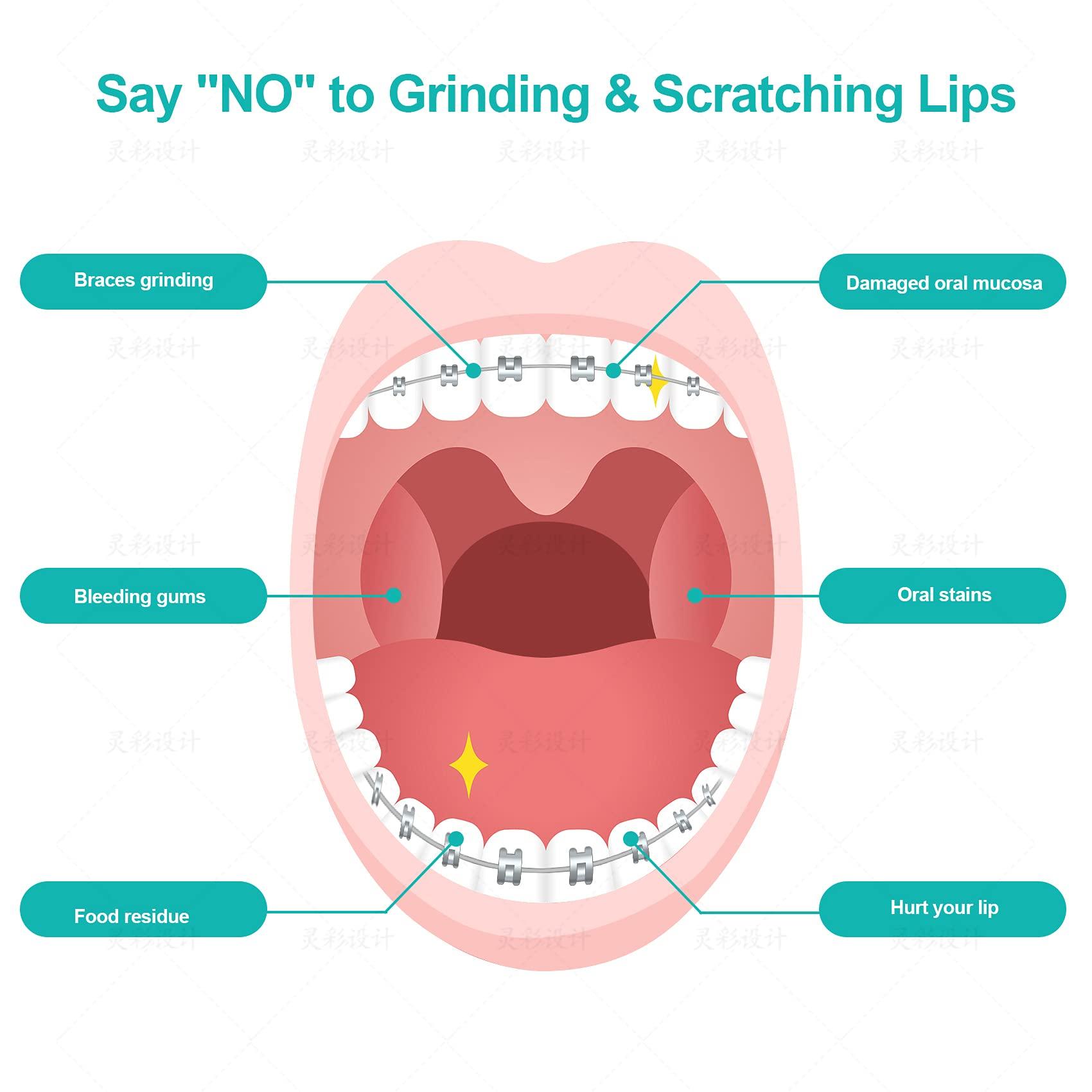 Annhua Annhua Orthodontist Wax Brace Wax Flavored 10 Pack, Dental Ortho Dots Wax Strips for Aligners, Braces Wearer, Brackets, Invisible-lingers, 10 Fruit Smell