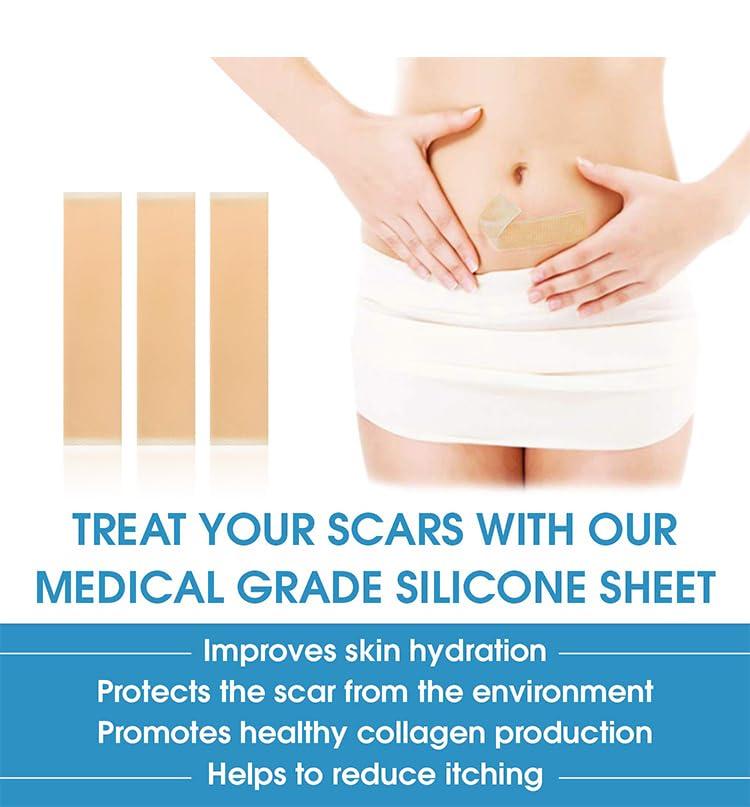 EASTHILL EASTHILL Silicone Scar,Silicone Scar Tape Effective Scar Removal Sheets, Silicone Scar Removal Sheets for Surgical Scars,Healing Keloid, C-Section, Tummy Tuck (SCARE SHEET)