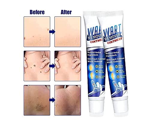 1 Warts Remover Cream 20g Extract Skin Face Tag Extract Corn Treatment Ointment Painless For Men Women and Childrens - (Pack of 1)