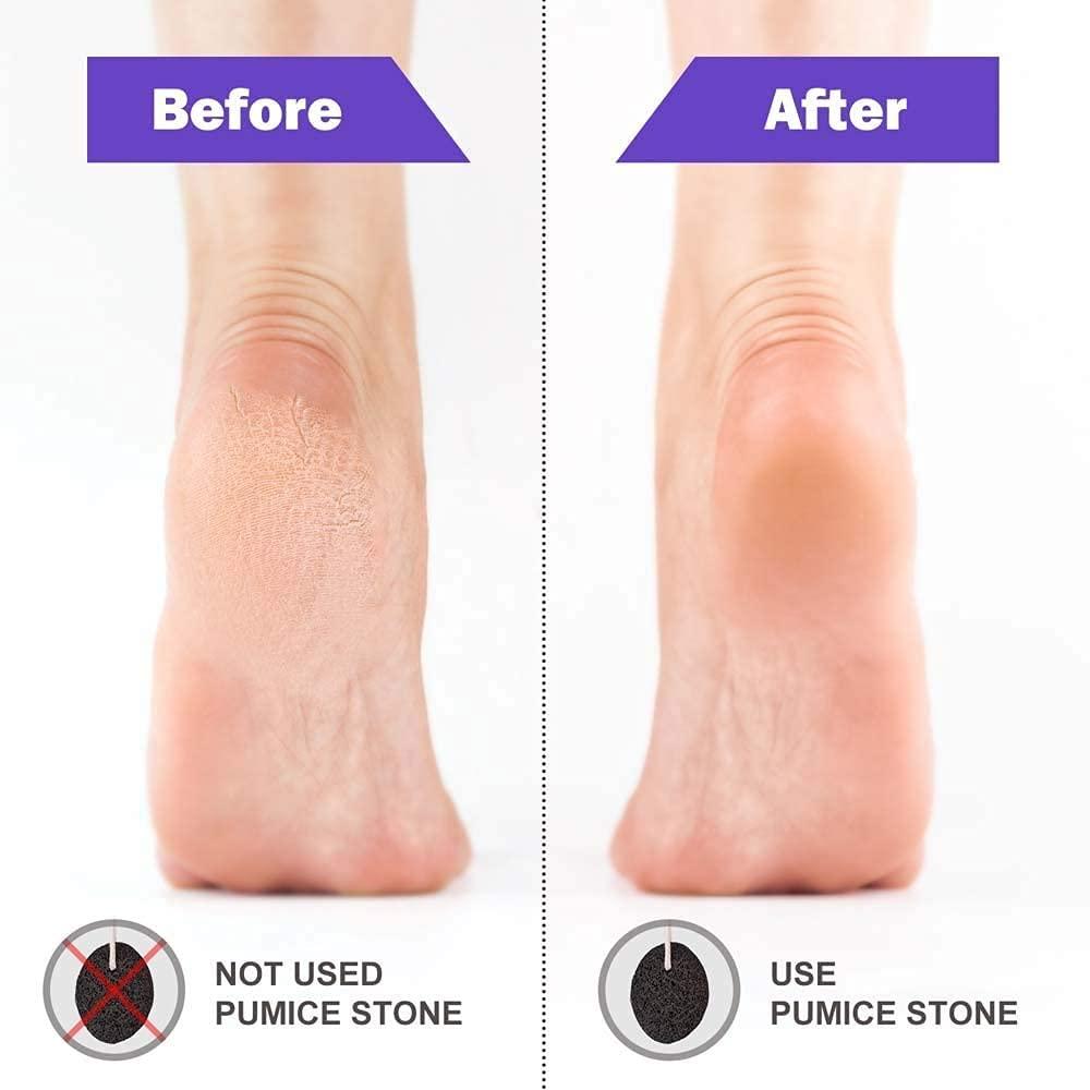 Red Square Pumice Stone 2 Pcs, Natural Lave Pumice Stone for Feet/Hand, Small Callus Remover/Foot Scrubber Stone for Men/Women - Multicolor (heart)