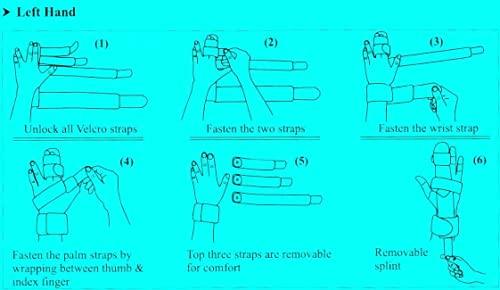 WITSOUL WITSOUL Two Fingers Splint Trigger Finger Adjustable Brace, Metal Straightening Immobilizer Splint Full Hand and Wrist Support fit Left and Right BOTH HAND (M)
