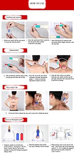 ZCOINS Kangzhu 24-Cup Biomagnetic Chinese Cupping Therapy Set