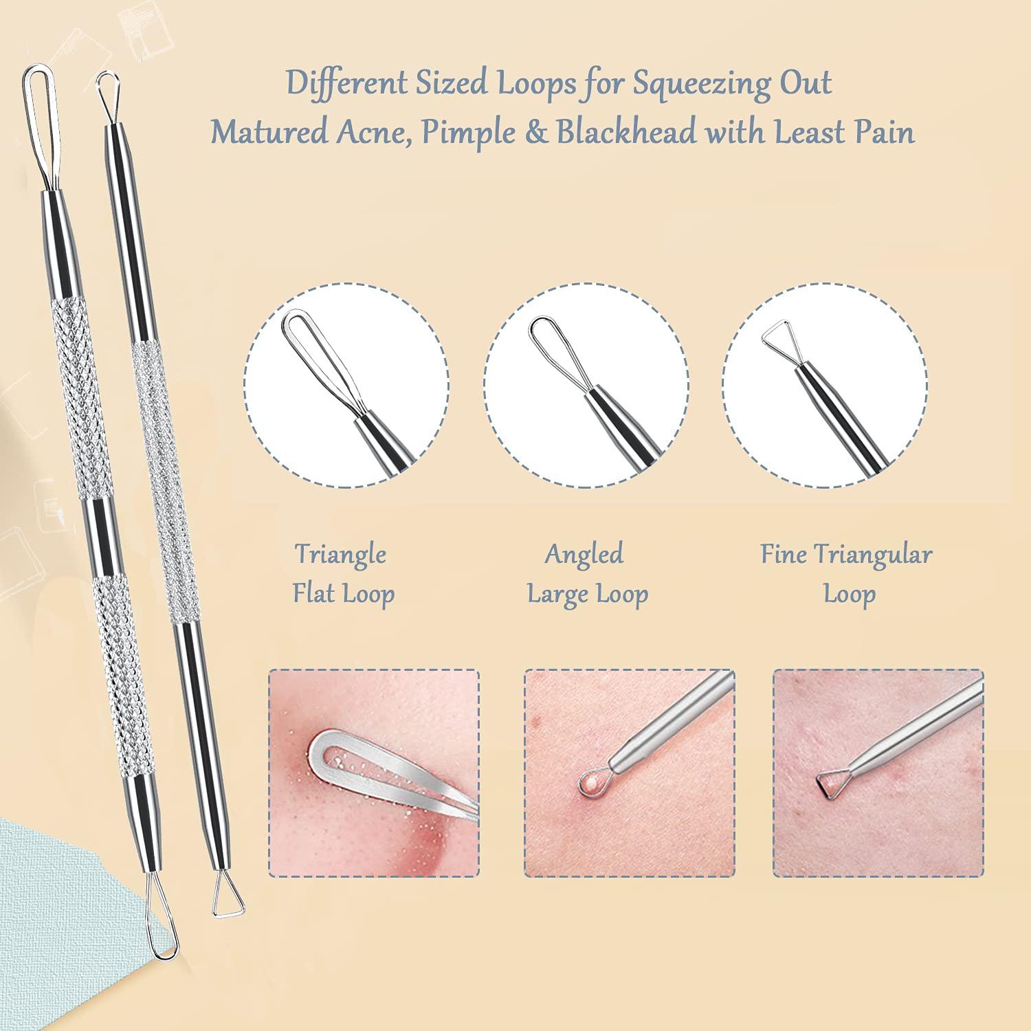 SKINOSM SKINOSM Blackhead Remover Acne Pimple Comedone Extractor Curved Whitehead Tweezers Tool Kit Treatment for Facial Skin Care Protect with Silver Metal Case (Tweezers Kit 6pcs)