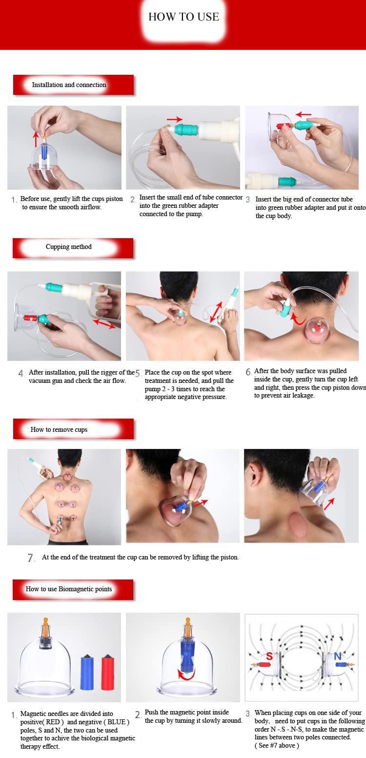 ZCOINS Kangzhu 24-Cup Biomagnetic Chinese Cupping Therapy Set
