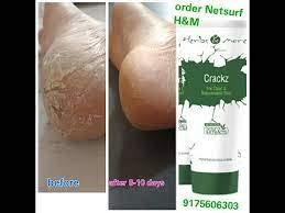 Generic Netsurf Herble Crack Cream Netsurf 75 gm